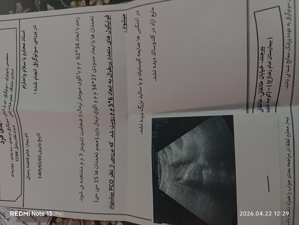 سونوم اینه سونوم اینه