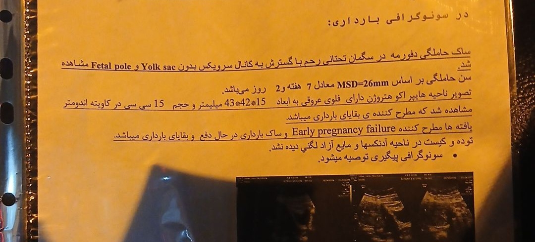 اینم سونوش 
