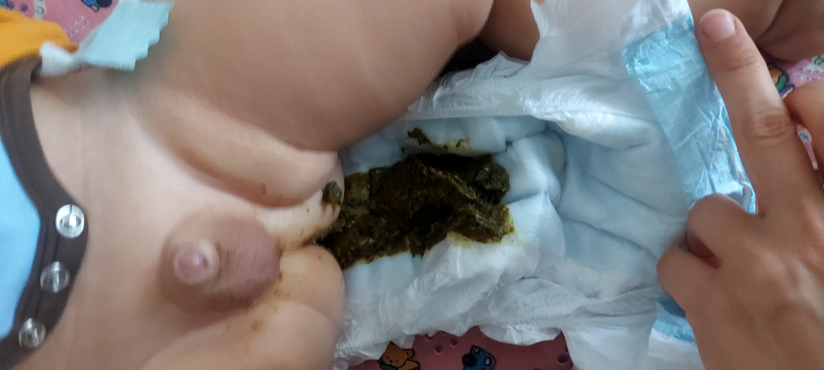 اسهال ، خوردن شیر گاو اسهال ، خوردن شیر گاو