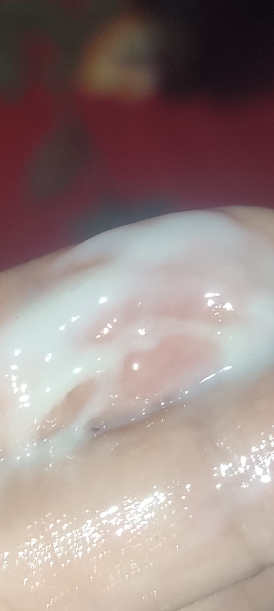 ترشحات سفید شیری در بارداری ترشحات سفید شیری در بارداری