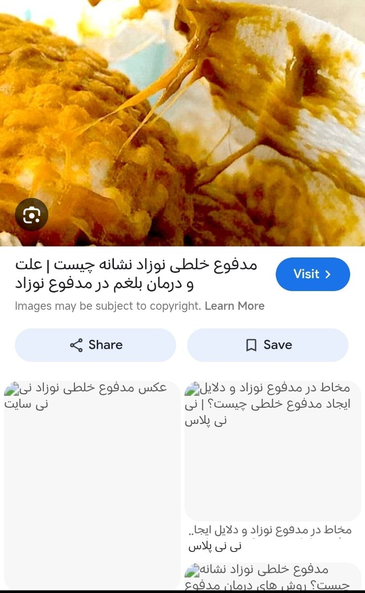 تجربه تون از رفلاکس پنهان و حساسیت به پروتیین گاوی تجربه تون از رفلاکس پنهان و حساسیت به پروتیین گاوی