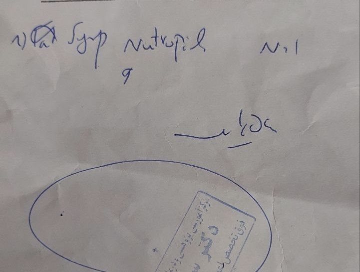 حرف نزدن دختر۲۵ماهه