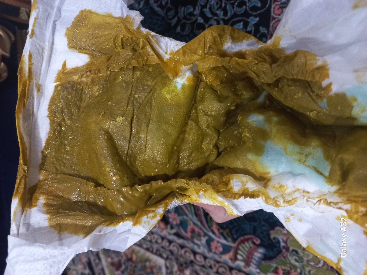 سرماخوردگی تب در نوزاد ۲ماهه سرماخوردگی تب در نوزاد ۲ماهه