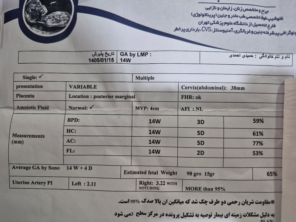 ستایم دقیق سونو آنومالی ستایم دقیق سونو آنومالی