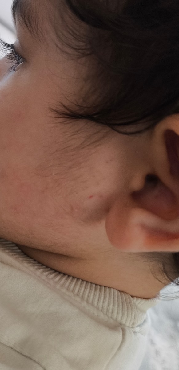 دخترم صورتشو چنگ میزنه