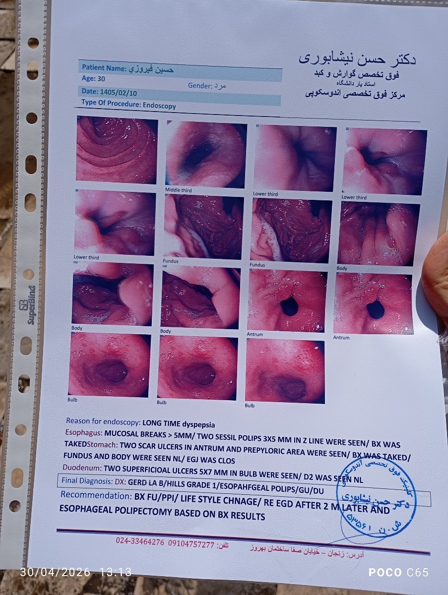 تفسیر جواب اندوسکوپی همسرم تفسیر جواب اندوسکوپی همسرم