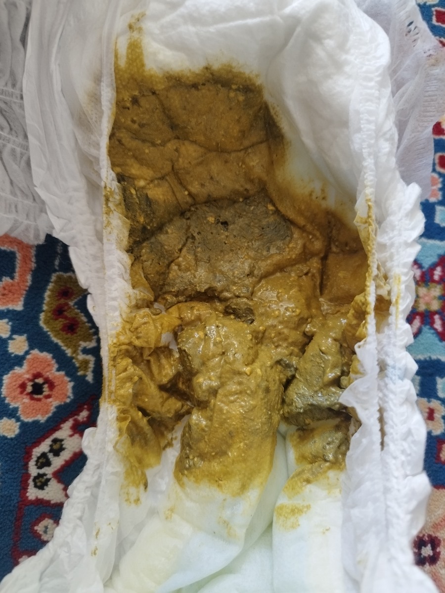 شیر مناسب نوزاد 8ماهه