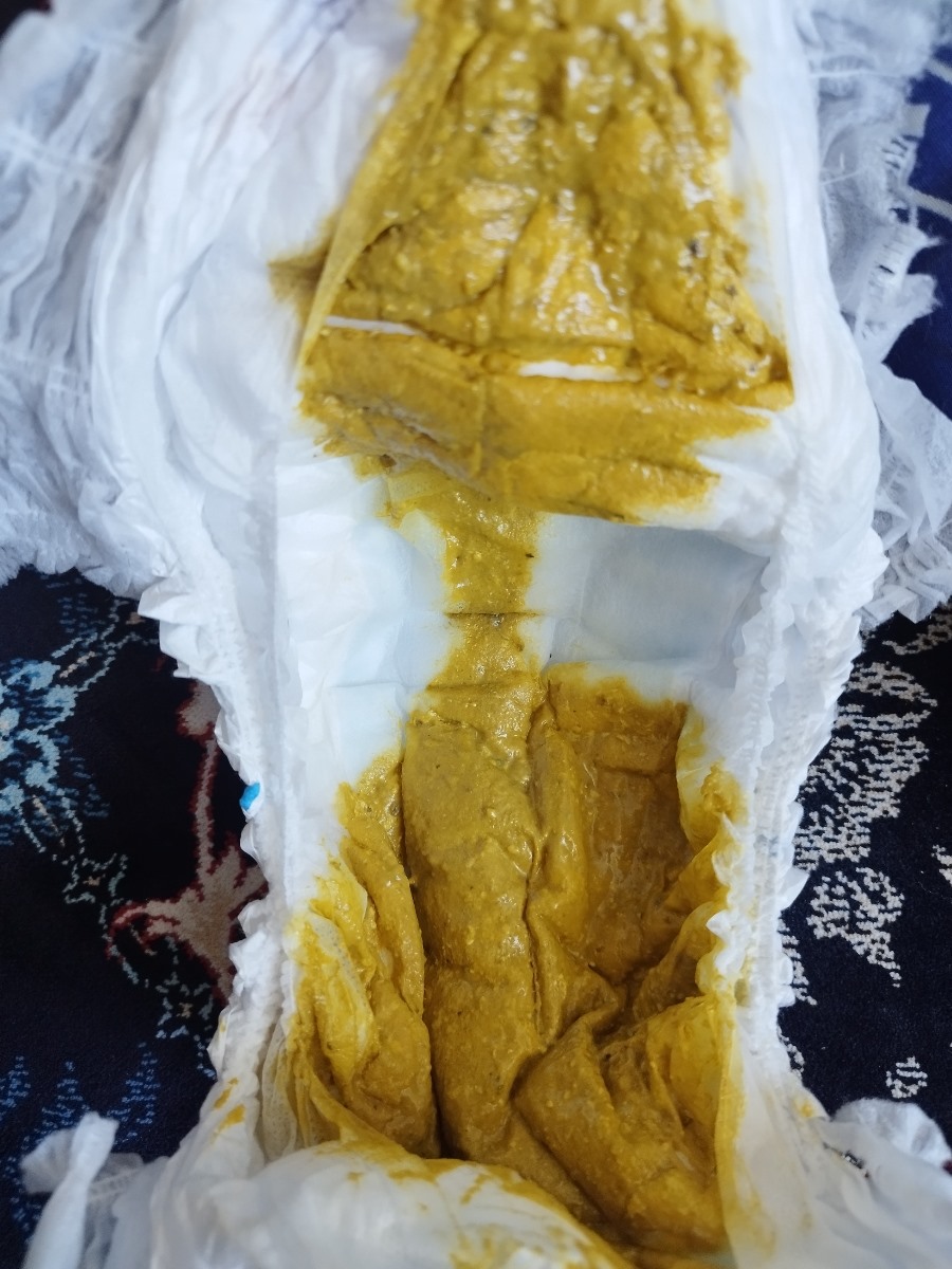 شیر مناسب نوزاد 8ماهه