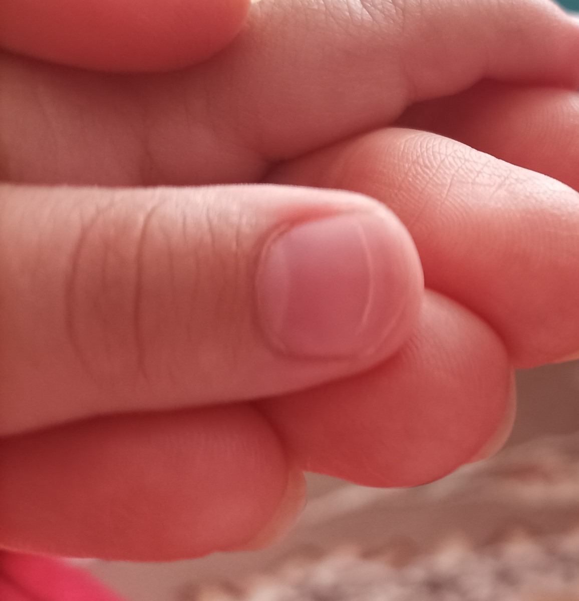 خط افتادن وشکنندگی ناخن