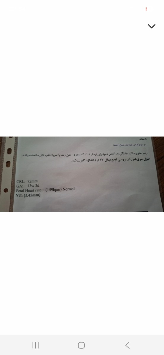 جواب سونوی انومالی چطوره جواب سونوی انومالی چطوره