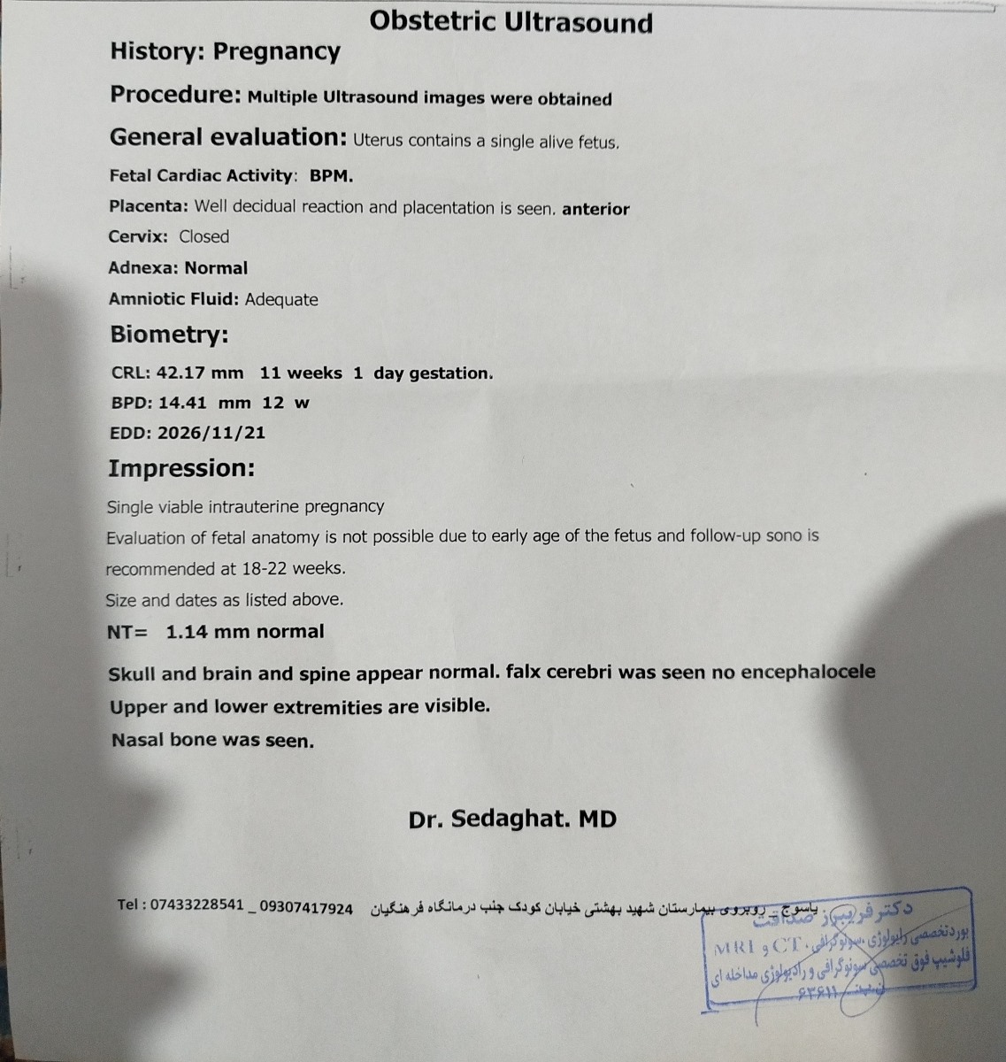 سنو ان تی لطفا ببینین