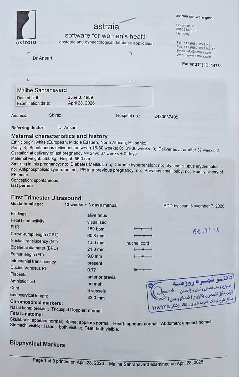 تعیین جنسیت نوزاد دختر یا پسر