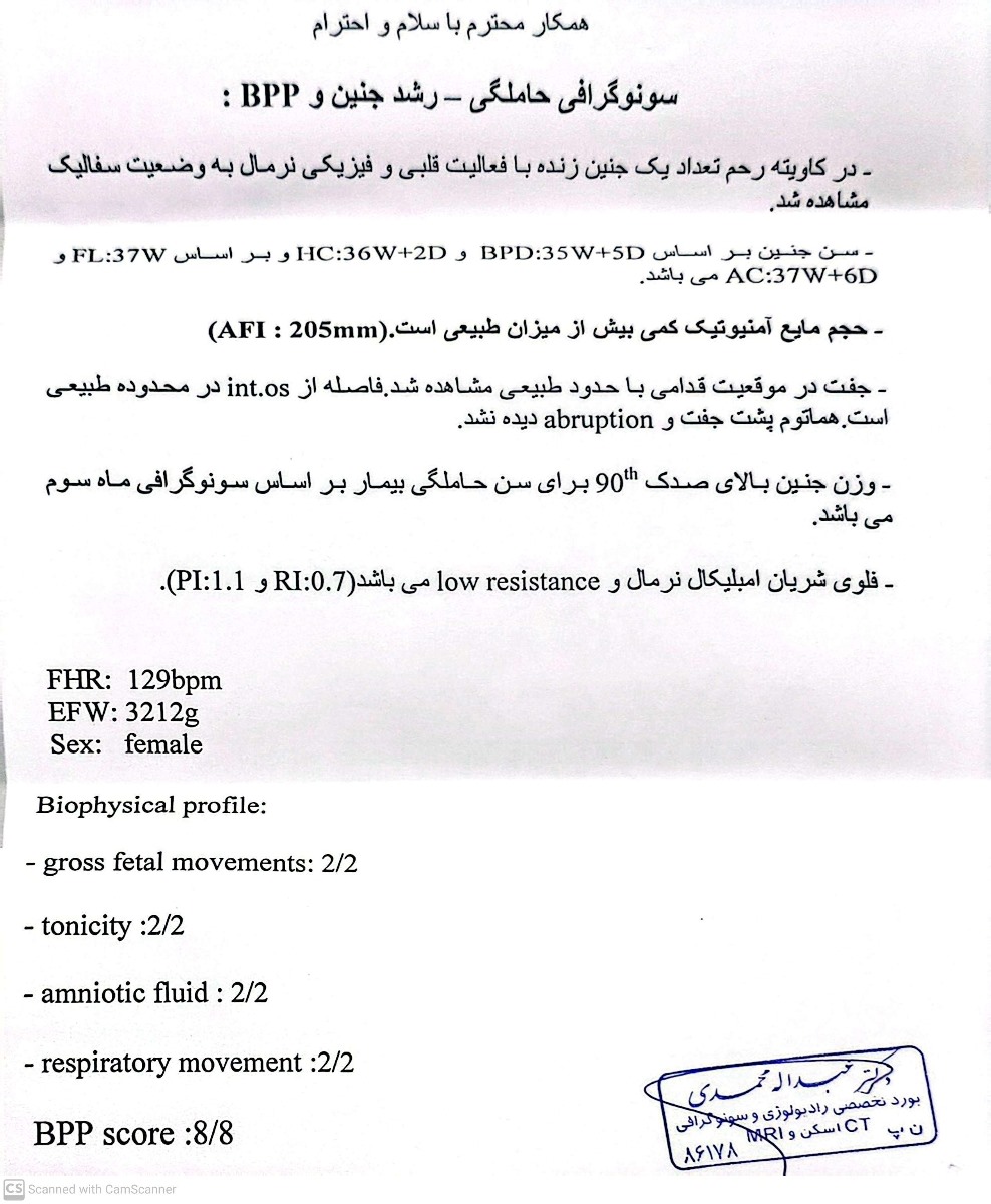 سونو بایوفیزیکال ۳۶ هفتگی سونو بایوفیزیکال ۳۶ هفتگی