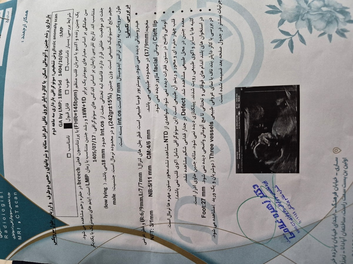 لطفا تفسیر سونوی آنومالی