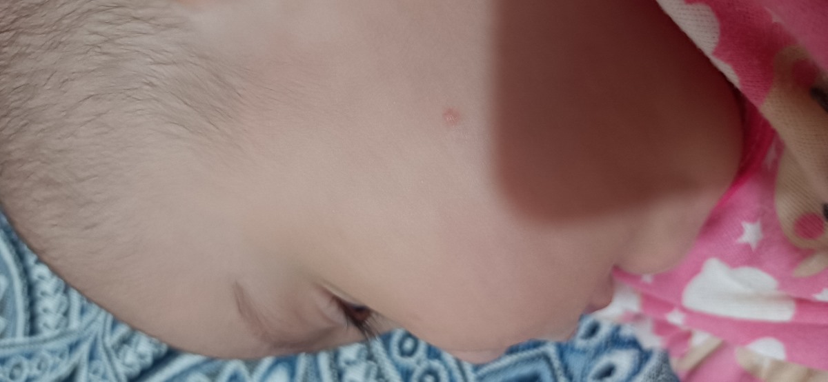 عوارض واکسن شش ماهگی