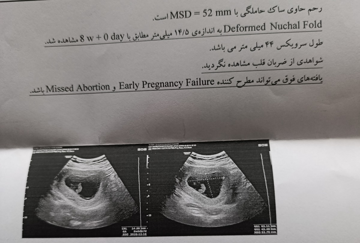 خانم دکتر لطفا در مورد شرایط من زودتر نظر بدین در حال سقط جنین هستم خانم دکتر لطفا در مورد شرایط من زودتر نظر بدین در حال سقط جنین هستم
