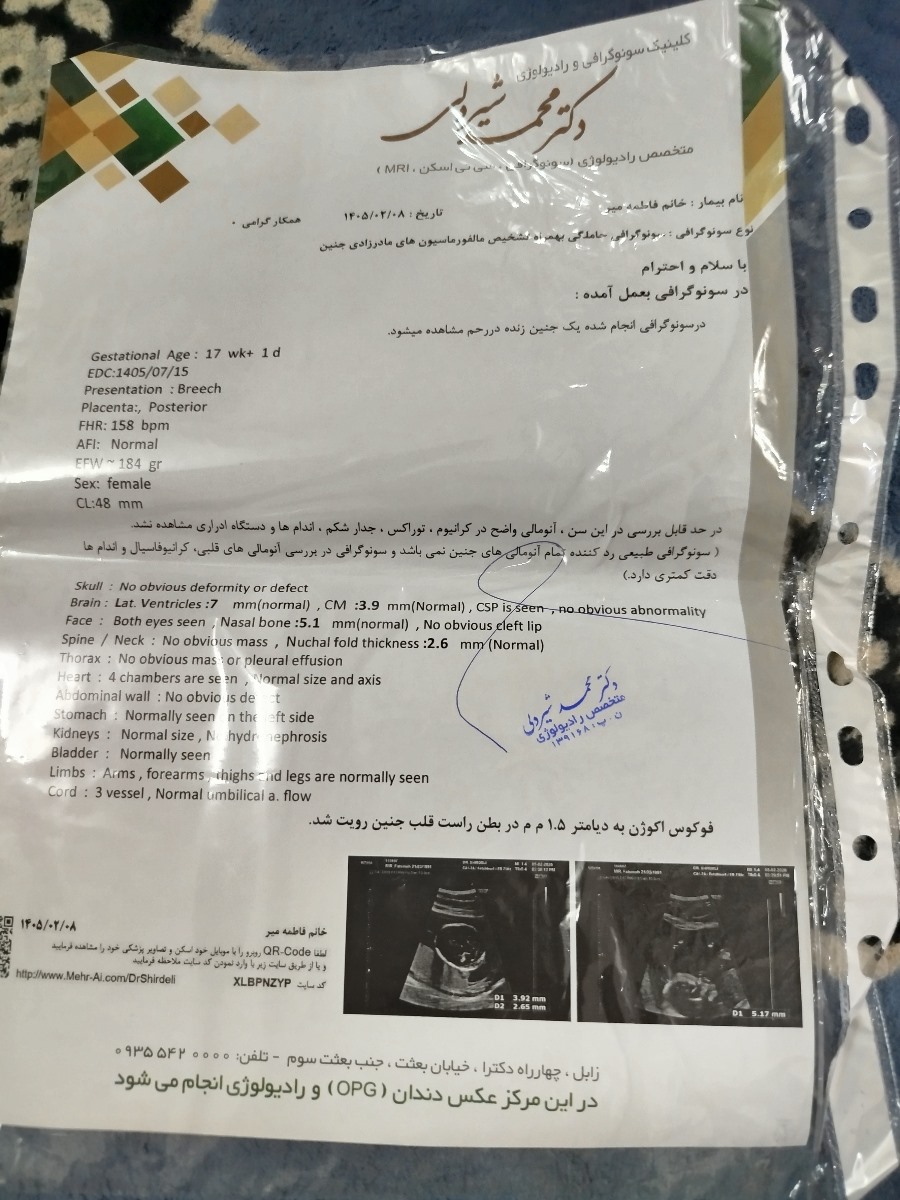 لطفا سنو آنومالی تفسیر کنید