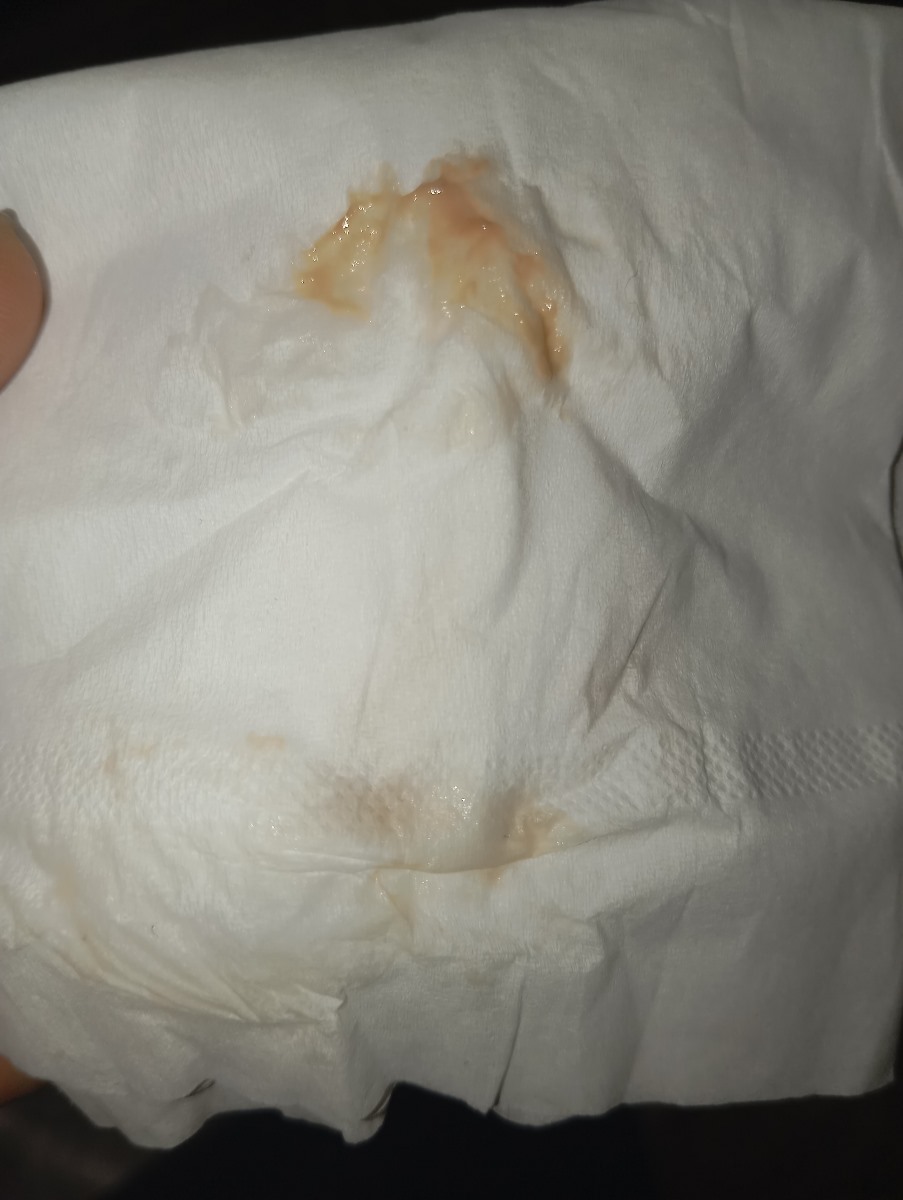ترشح مایل به صورتی اگه خطرناکه برم بیمارستان ؟