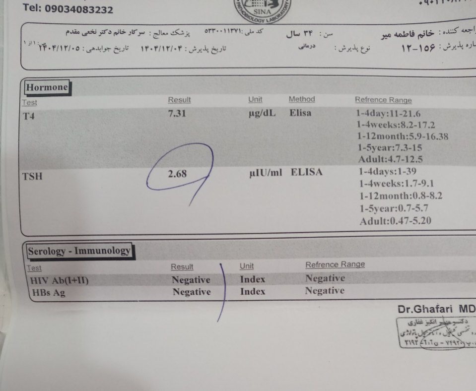 لطفا سنو آنومالی تفسیر کنید