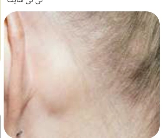خیلی کوچکتر از اینه اصلا با چشم زیاد دیده نمیشع ولی جاش همینجاس