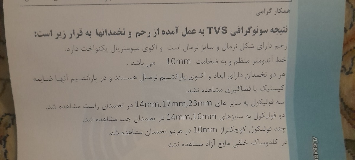 اینم سنو