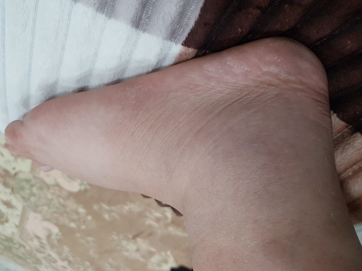 ورم پاها در هفته ۳۹ ... ورم پاها در هفته ۳۹ ...