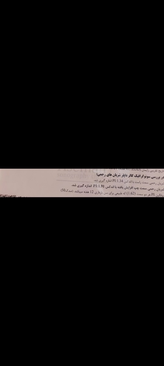 مصرف آسپرین و عوارض آن در بارداری مصرف آسپرین و عوارض آن در بارداری
