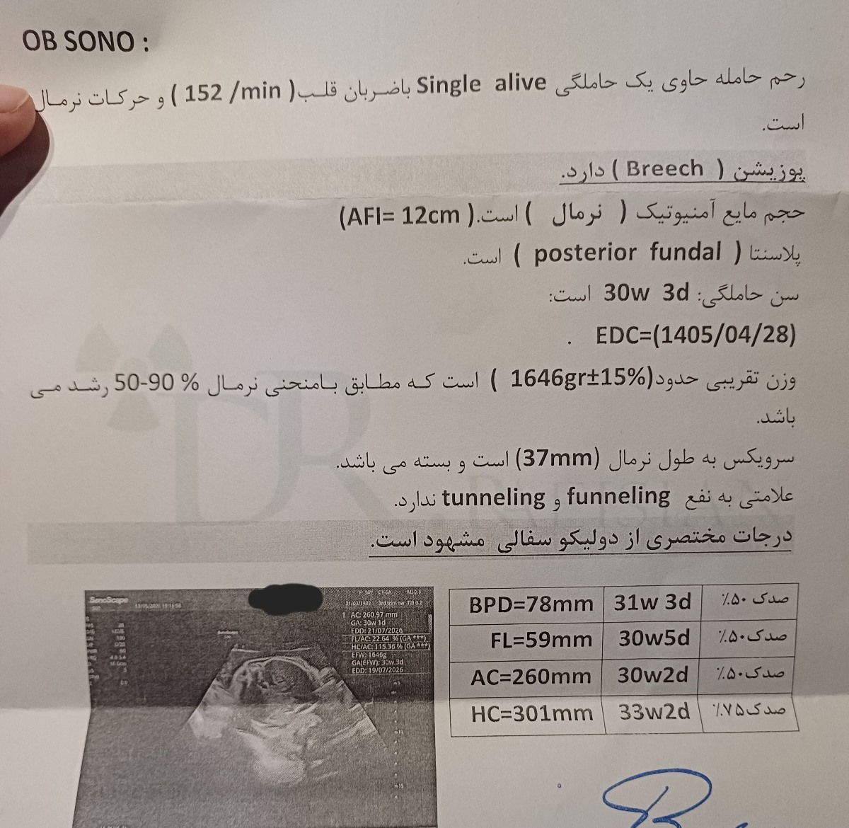 دولیکو سفالی جنین و hc زیاد دولیکو سفالی جنین و hc زیاد