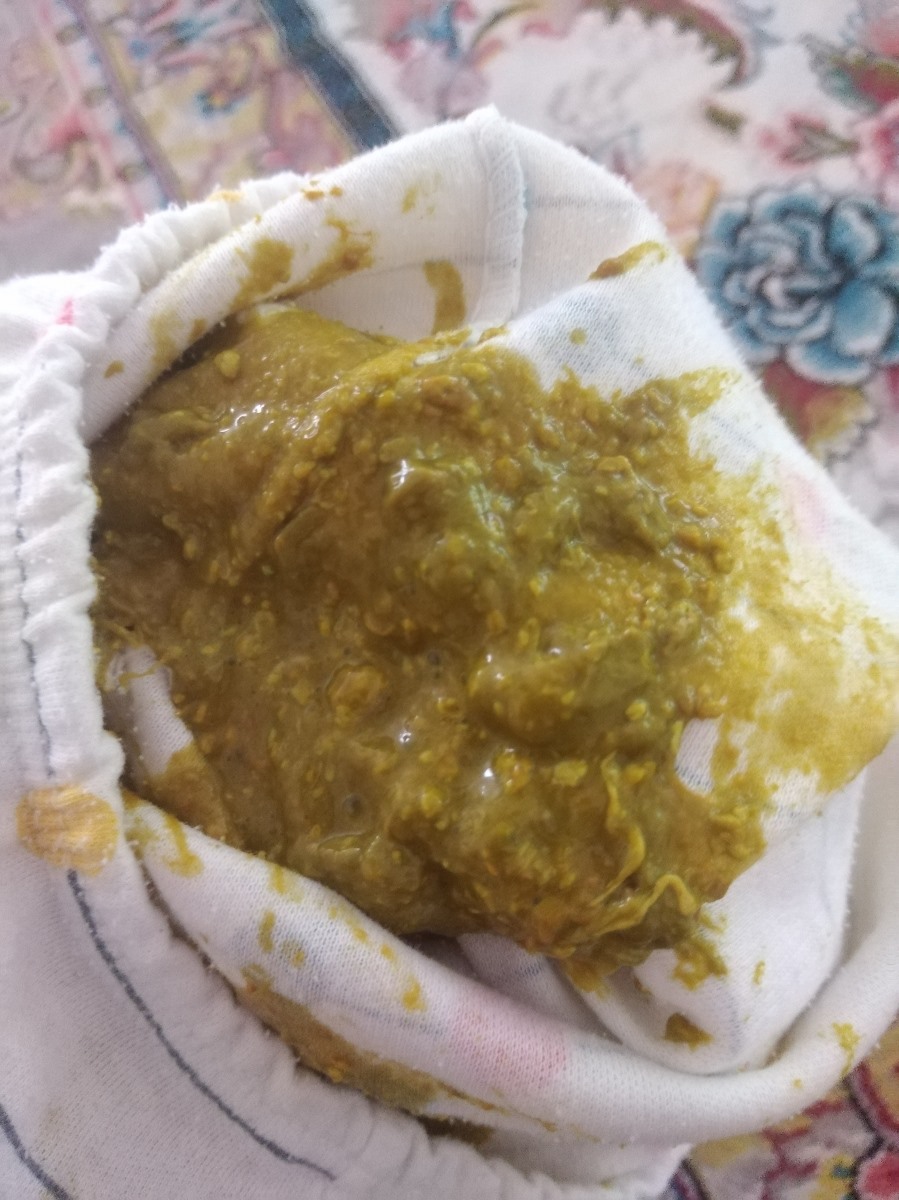 یبوست نوزاد 2 ماهه یبوست نوزاد 2 ماهه