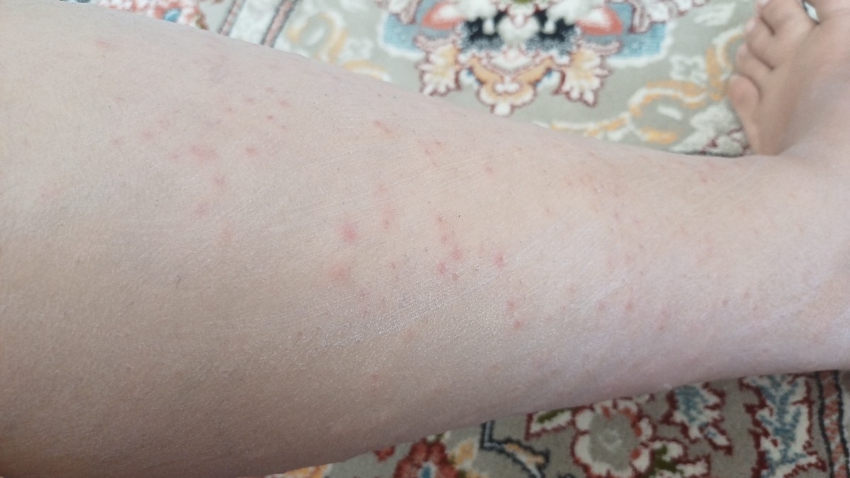 فقط نصف دونه ها تو عکس افتاده اصلا جای خالی روی پام نیس فقط نصف دونه ها تو عکس افتاده اصلا جای خالی روی پام نیس