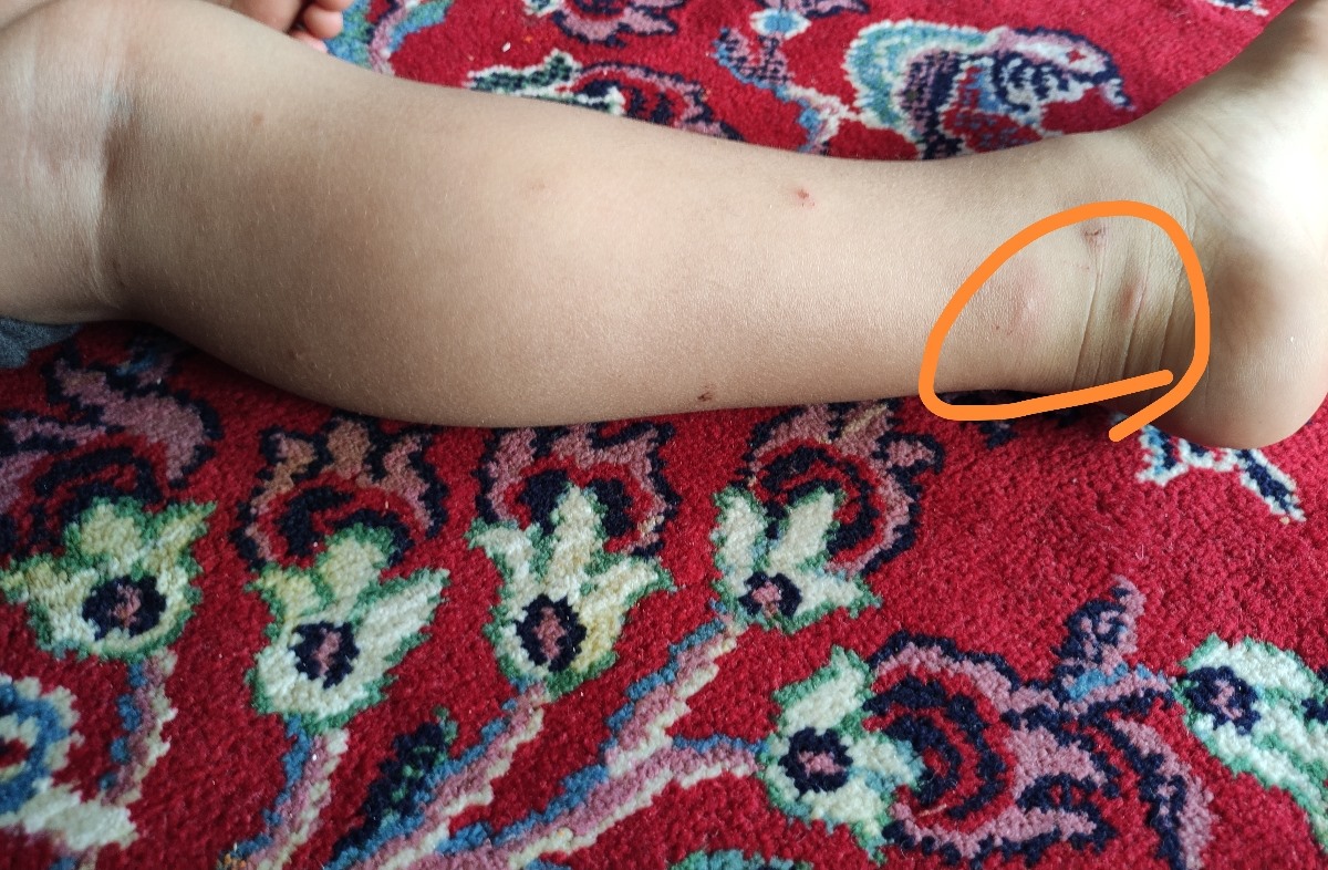 جایی که خط کشیدم امروز میخارید
