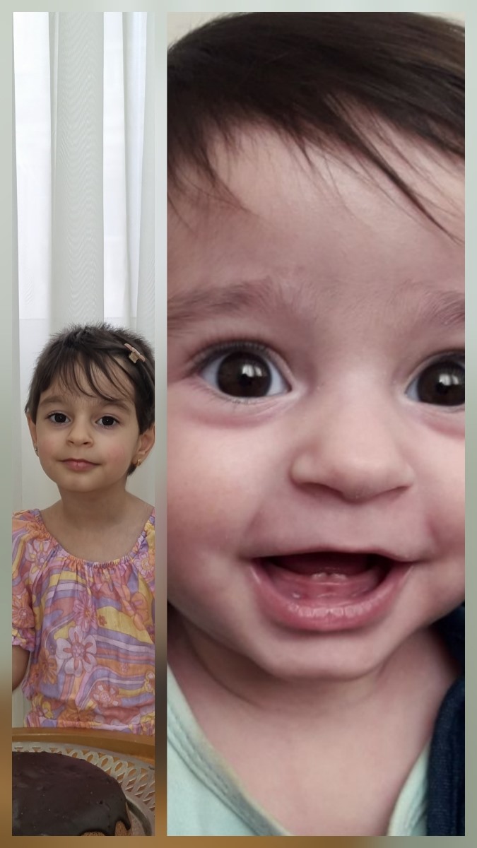 کوتاه بودن پوست گردن نوزاد کوتاه بودن پوست گردن نوزاد