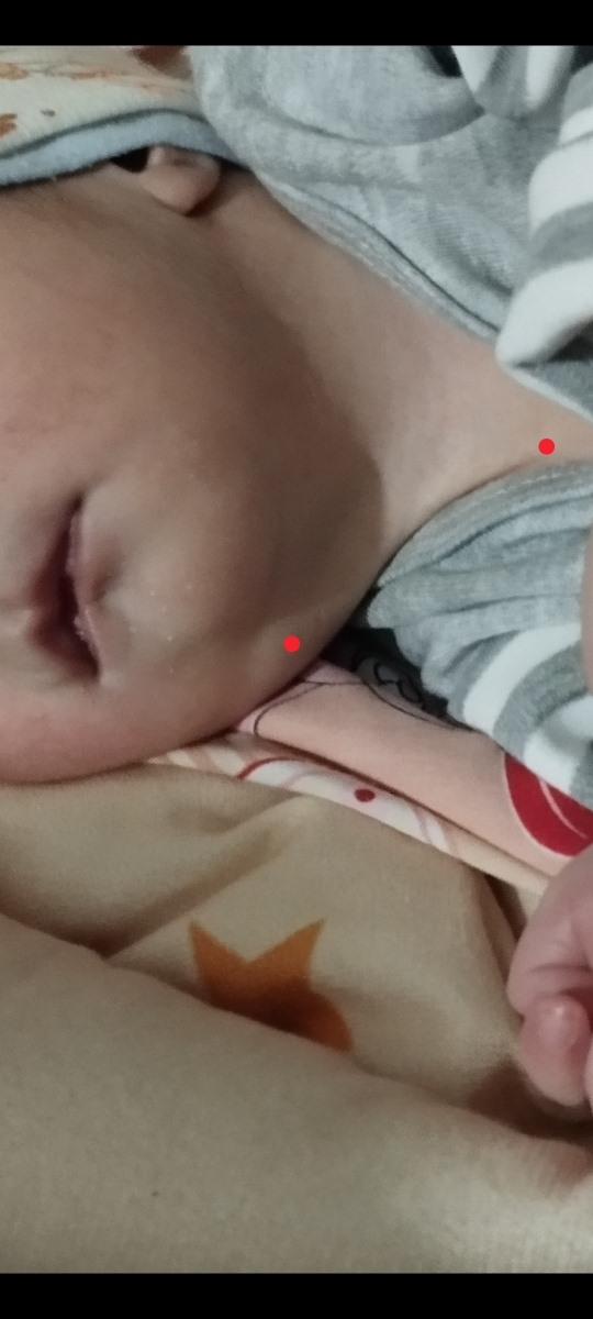 بچه ها ببینید این دو نقطه مستقیم بهم وصله نباید این پوست چونه اش میرفت سمت گردن بعد به پایین وصل میشد؟
الان مستقیم از چونه به پایین وصله همین نگرانم کرده
وگرنه چاق بودن و غبغب داشتن رو میدونم بچه ها ببینید این دو نقطه مستقیم بهم وصله نباید این پوست چونه اش میرفت سمت گردن بعد به پایین وصل میشد؟
الان مستقیم از چونه به پایین وصله همین نگرانم کرده
وگرنه چاق بودن و غبغب داشتن رو میدونم