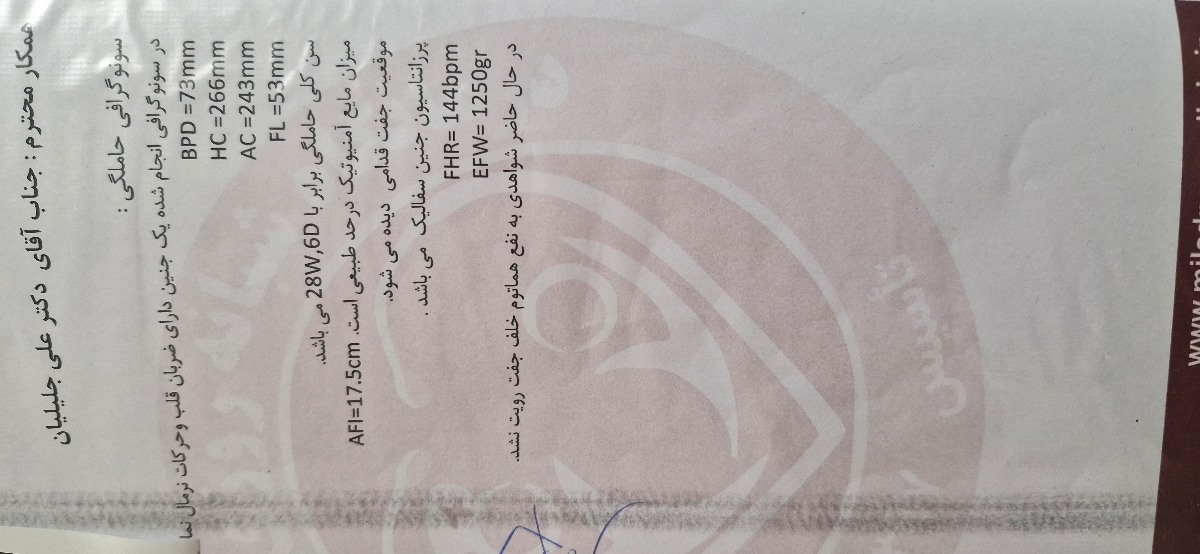 وزن جنین در ۲۸دهفته ۶روز