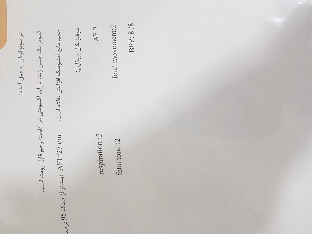 سونو هفته ۴۰و افزایش مایع دور جنین ...خانم دکتر عزیز❤