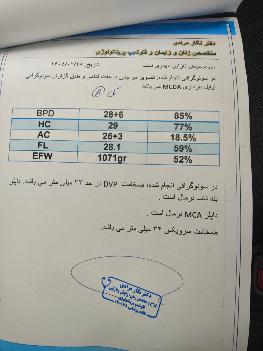 سونوی جدید