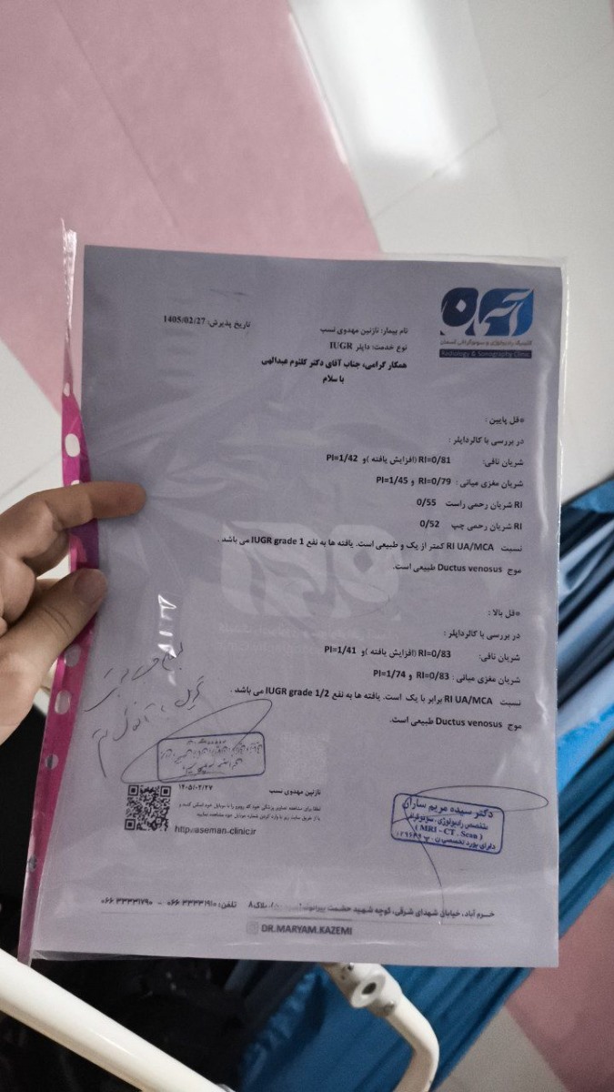 مونوکوریون و بند ناف دور گردن نوزاد