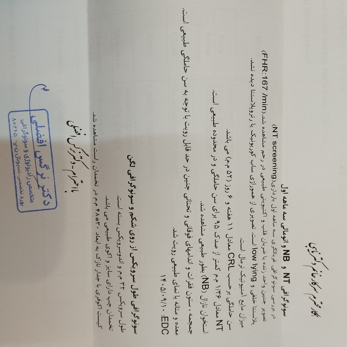 سونوی ان تی ، تشخیص جنسیت سونوی ان تی ، تشخیص جنسیت