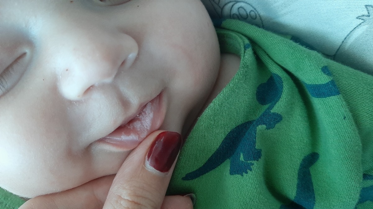 خانم دکتر دهن پسرم آفت و برفک زده چکار کنم خانم دکتر دهن پسرم آفت و برفک زده چکار کنم