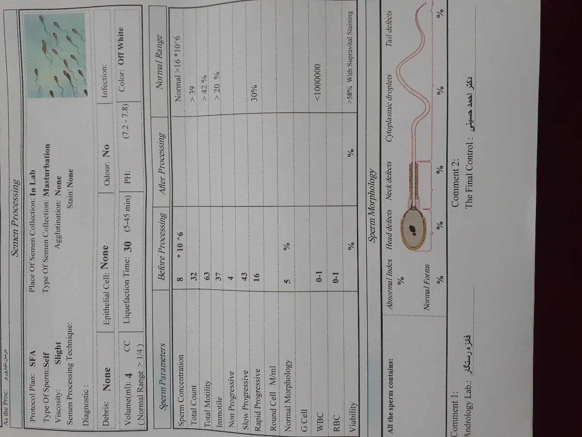 تفسیر ازمایش اسپرم
