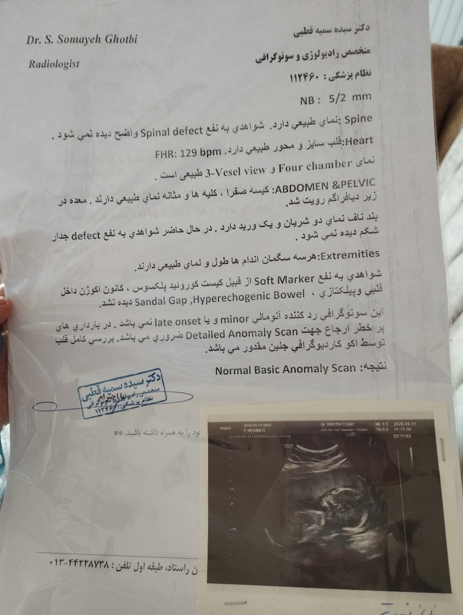 صفحه دوم سونوگرافی آنومالی
آکوی قلب جنین هم انجام دادم همه چیزش شکر خدا عالی بود صفحه دوم سونوگرافی آنومالی
آکوی قلب جنین هم انجام دادم همه چیزش شکر خدا عالی بود