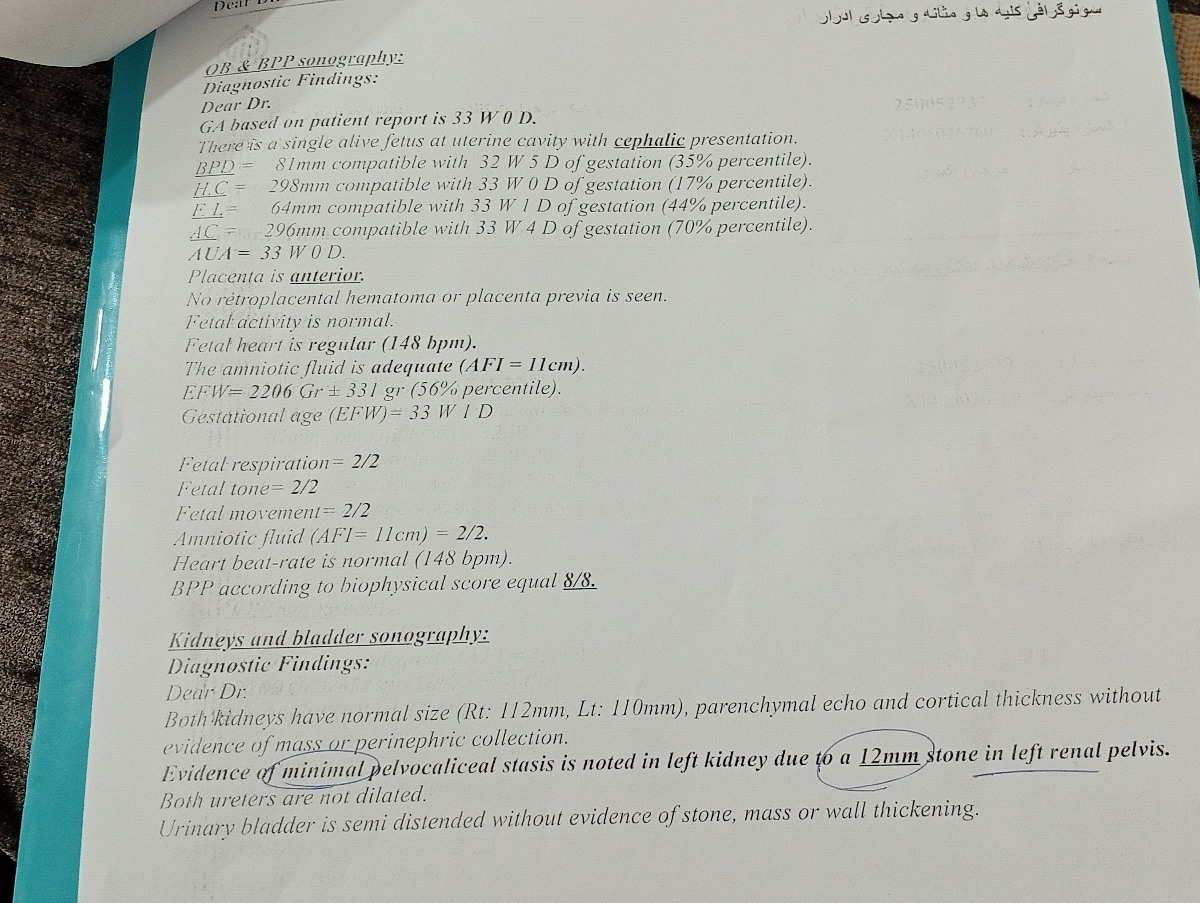 اینم سونو اینم سونو