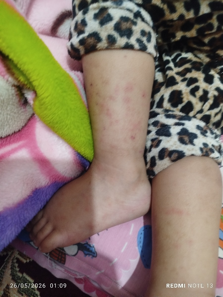این یکی پاهاش بیشتره