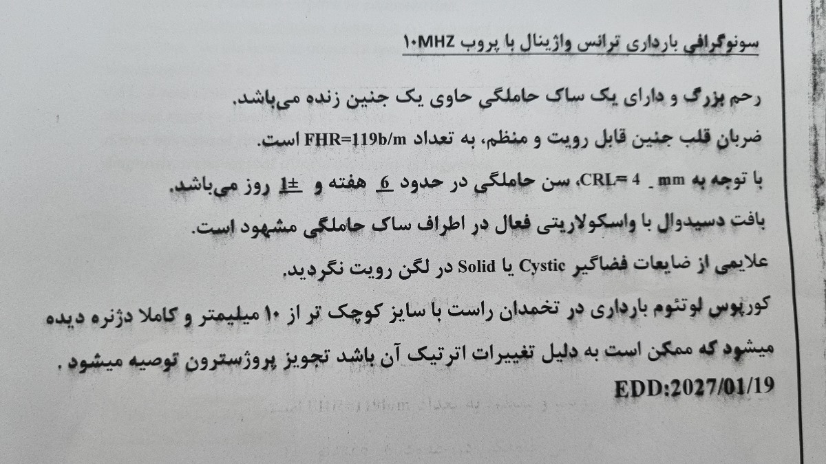 اینم سونو واژینالم که بعدش رفتم و بچه رو دید اینم سونو واژینالم که بعدش رفتم و بچه رو دید