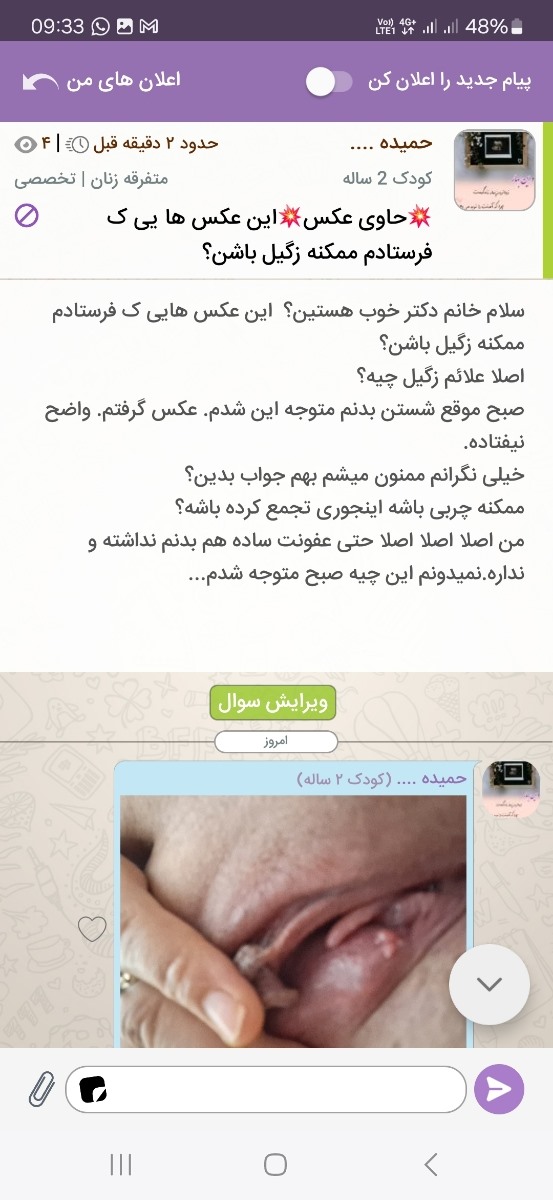سلام خانم دکتر.ممنون میشم این تاپیک منو جواب بدین دارم از استرس میمیرم سلام خانم دکتر.ممنون میشم این تاپیک منو جواب بدین دارم از استرس میمیرم
