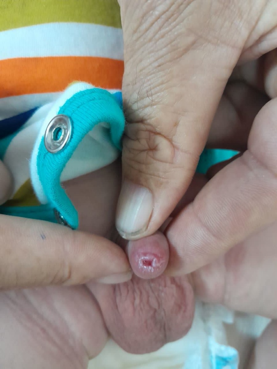 شکل آلت نوزاد 22 روزه با عکس شکل آلت نوزاد 22 روزه با عکس