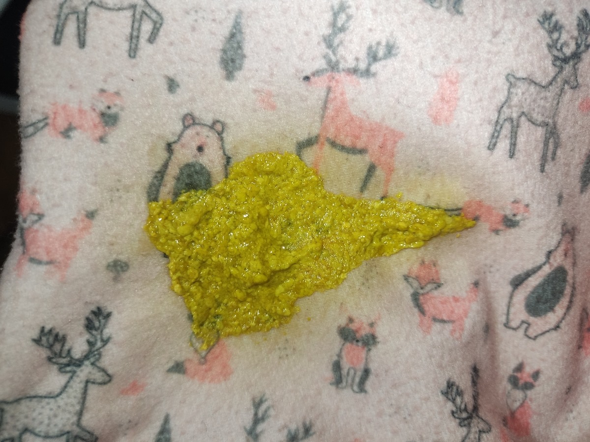 کف سر نوزاد یک ماهه