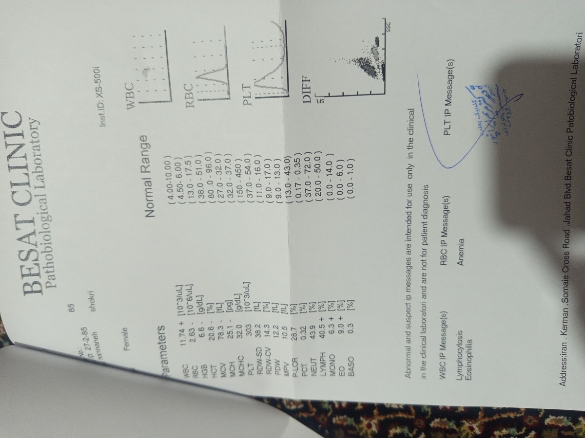 تفسیر آزمایش آبجیم میشه ببینین