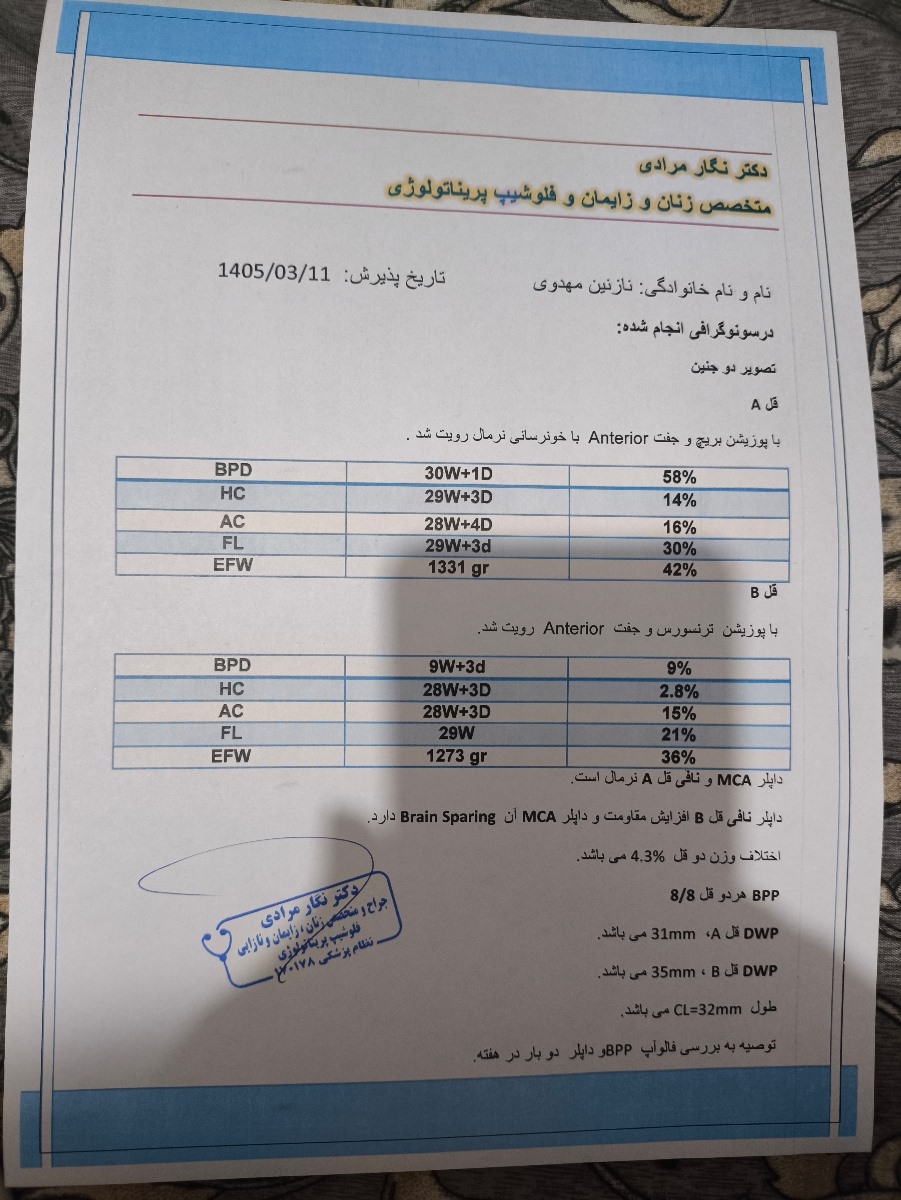 زایمان زودرس دوقلویی مونوکوریون دی آمنیون