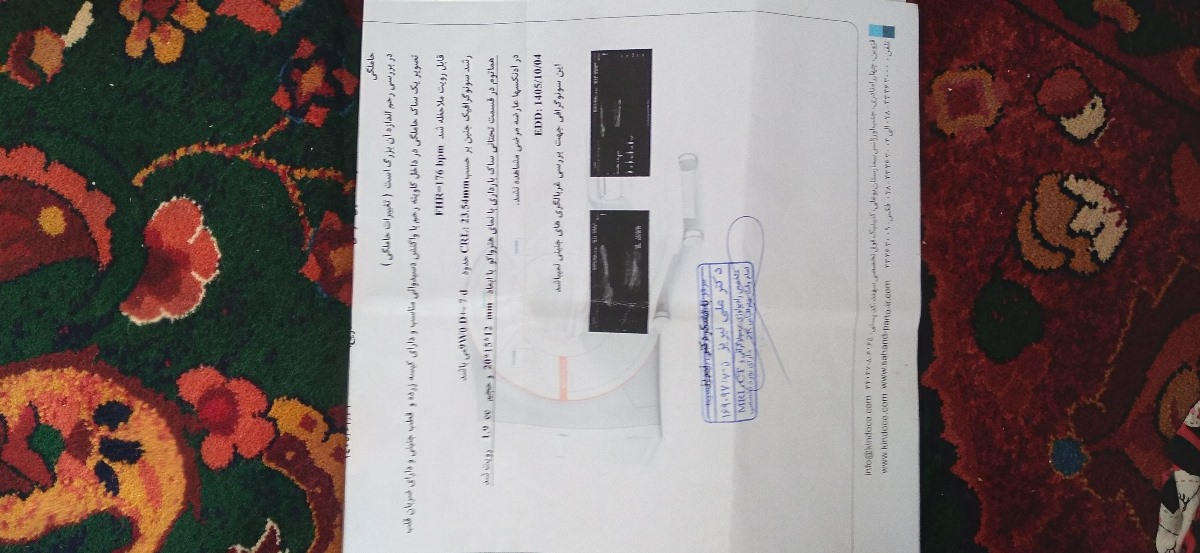 وجود هماتوم در بارداری خطرناک است یا نه